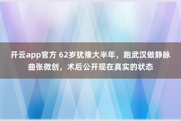 开云app官方 62岁犹豫大半年，跑武汉做静脉曲张微创，术后公开现在真实的状态